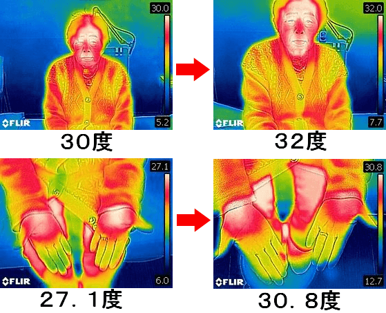 施術前後のサーモグラフィーによる体温変化の画像