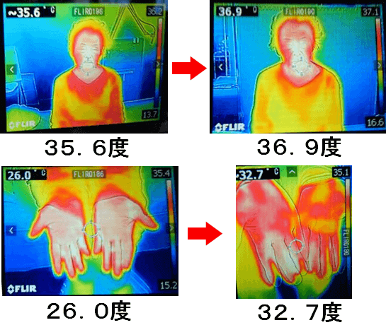 施術の前後の体温上昇の証拠写真