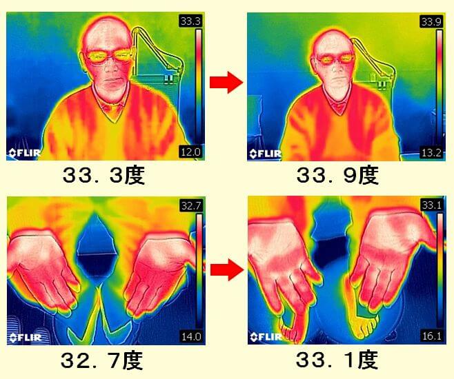 患者様の施術前後の写真